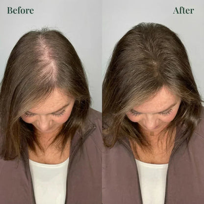 Kerarose Rosemary Shampoo For Hair Growth (Buy 1 Get 1 Free 🔥🔥)